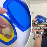 Na čo je vazelína: 12 spôsobov jej použitia, ktoré vás